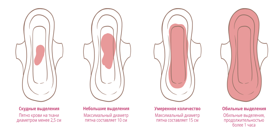 Обильные кровотечения во время менструации: что делать и к кому обращаться